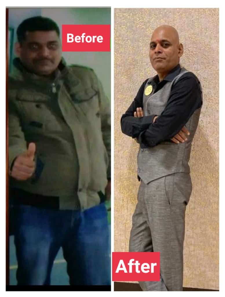 Before & After